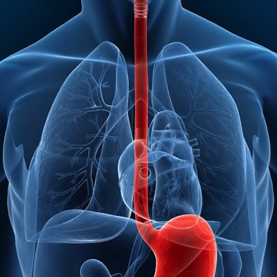 Oesophagial Surgery