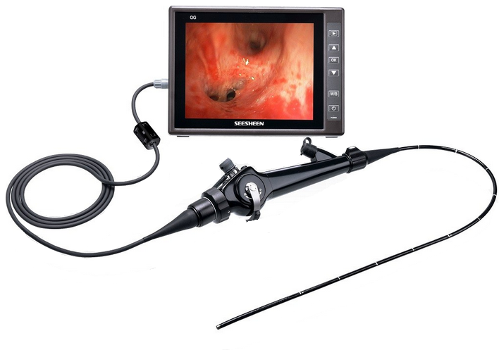 Endoscopy
