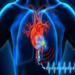 Pacemaker