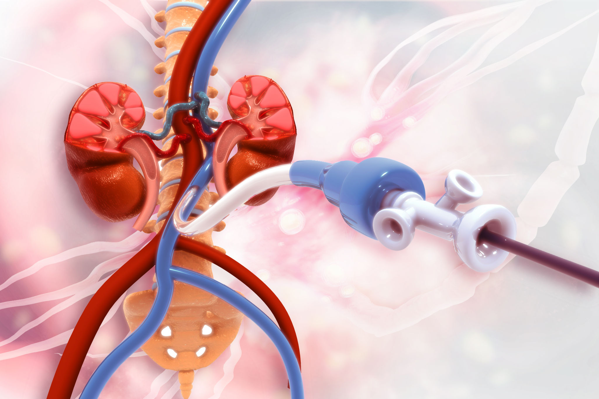 Major and Peripheral Vascular Surgery